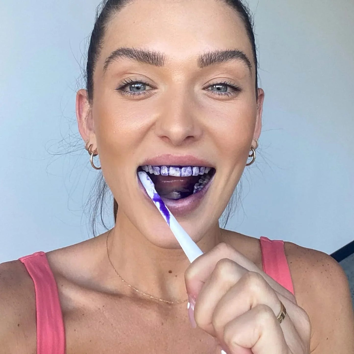 HiSmile V34 Purple Teeth Whitening Serum – Instant Stain Removal & Brighter Smile