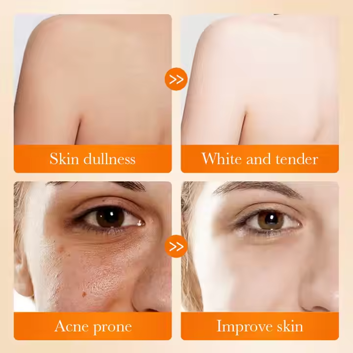 SADOER Kojic Acid Whitening Soap – For Radiant and Clear Skin
